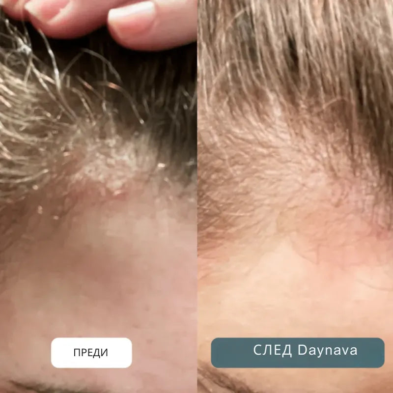 Успокояващ крем за скалп и кожа