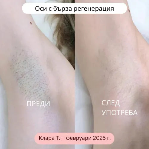 Daynava™ 5 в 1 Електрическа Самобръсначка