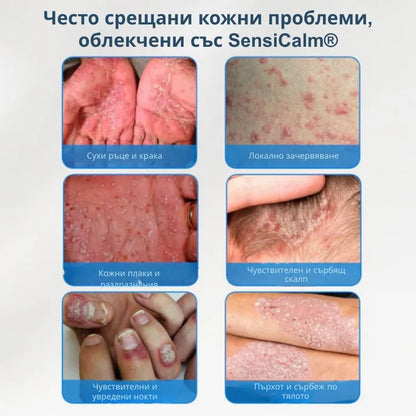 Успокояващ крем за скалп и кожа