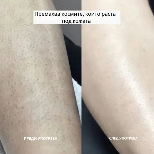 Daynava™ 5 в 1 Електрическа Самобръсначка