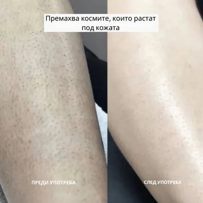 Daynava™ 5 в 1 Електрическа Самобръсначка
