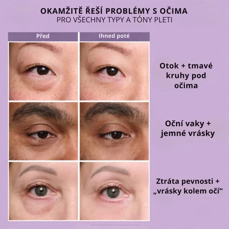 Daynava™ Okamžitý Lifter Očí CZ