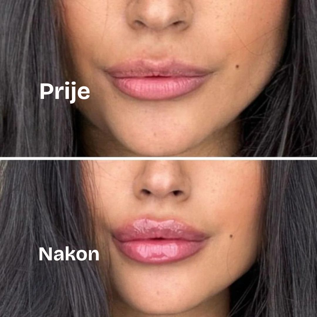 Daynava – Za pune, sočne usne HR