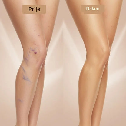 Daynava Set Četkica za Body Perfecter HR