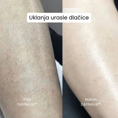 Daynava™ 5-u-1 Električni Brijač HR