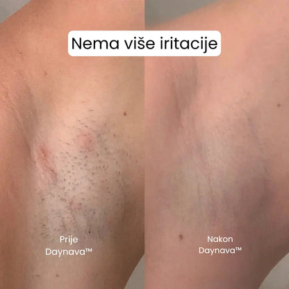 Daynava™ 5-u-1 Električni Brijač HR