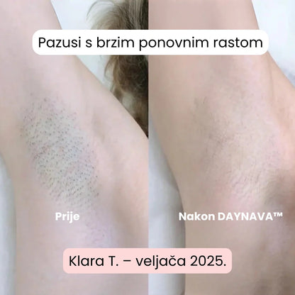 Daynava™ 5-u-1 Električni Brijač HR