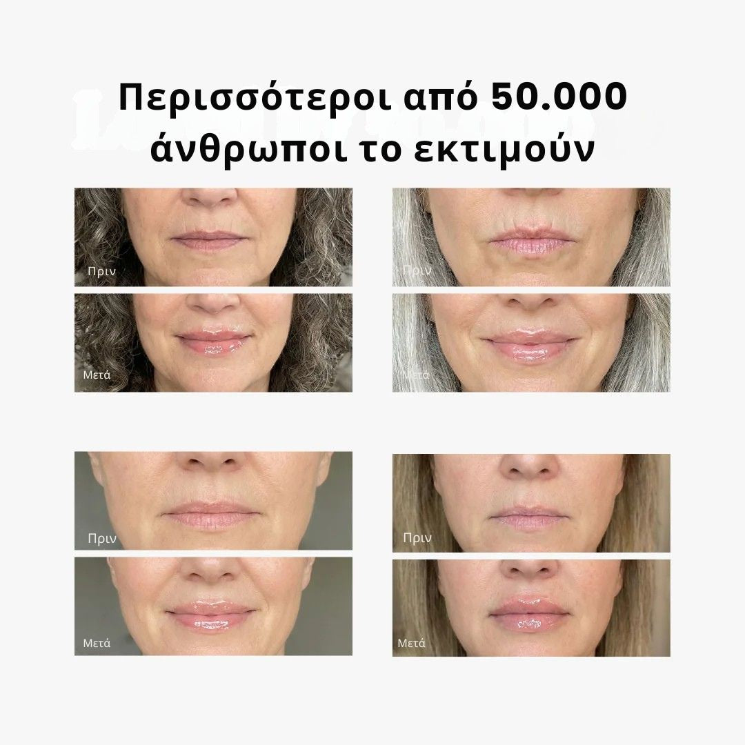 Daynava Lip Plumper — Πιο Γεμάτα Χείλη. Χωρίς Ενέσεις. Χωρίς Κάψιμο.