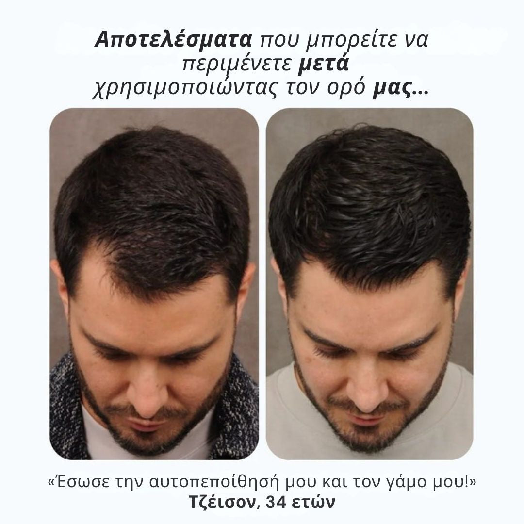 Daynava™ Roll-On για Ανάπτυξη Μαλλιών