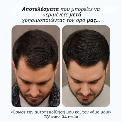 Daynava™ Roll-On για Ανάπτυξη Μαλλιών
