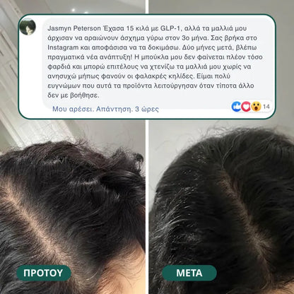 Βιταμίνες Βιοτίνης για Ανάπτυξη Μαλλιών