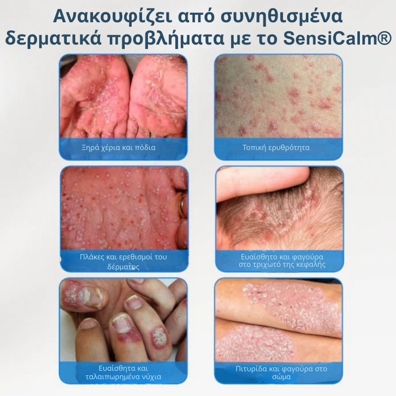 Καταπραϋντική Κρέμα για Τριχωτό & Δέρμα