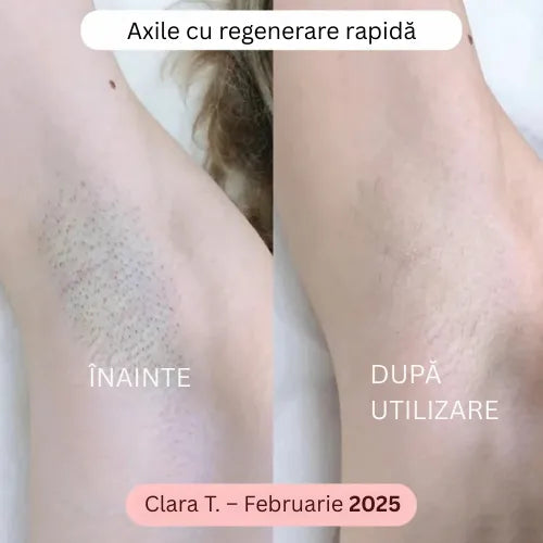 Daynava™ 5 în 1 Aparat de Ras Electric