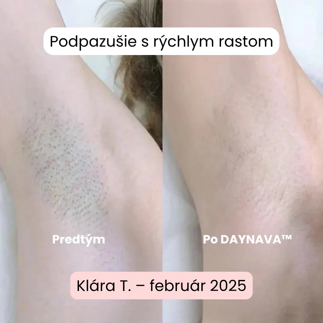 Daynava™ 5v1 Elektrický Holiaci Strojček