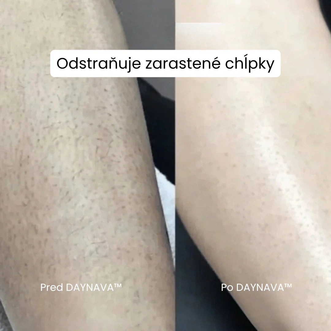 Daynava™ 5-v-1 Elektrický Holiaci Strojček