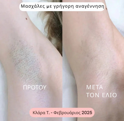 Daynava™ 5 - σε - 1 Ηλεκτρικό Ξυραφάκι - Daynava