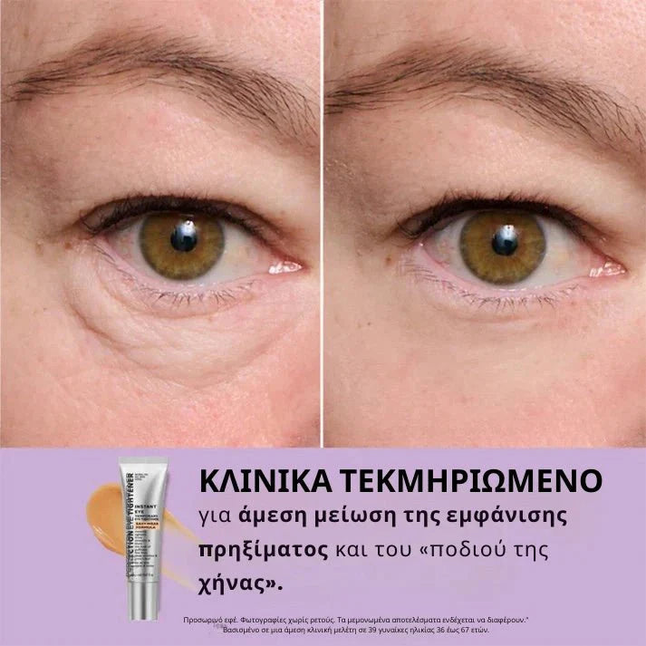 Daynava™ Άμεσος Ανυψωτής Ματιών - Daynava